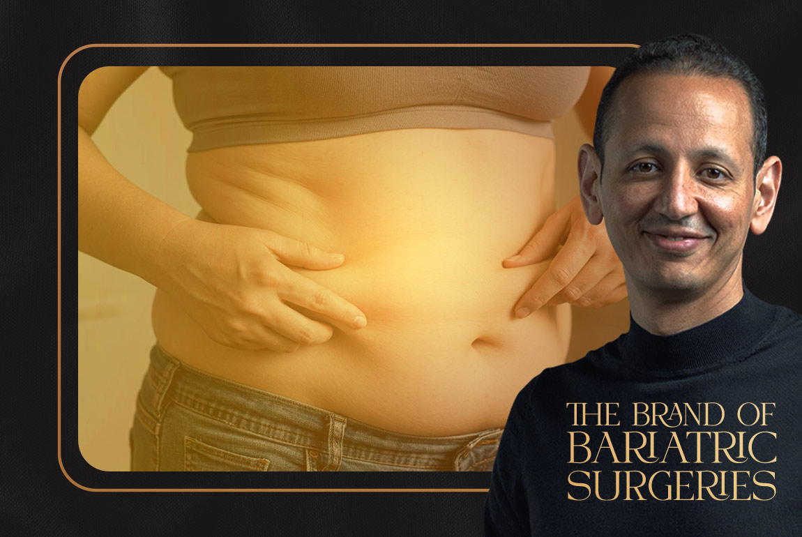what about sagging after bariatric surgeries what about sagging after bariatric surgeries